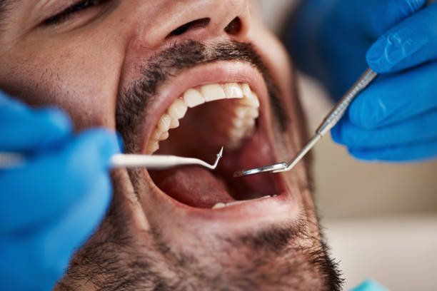Best Holiday Emergency Dentist in Roanoke, IL
